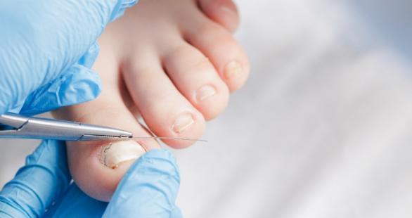  podologue diplômé Marseille