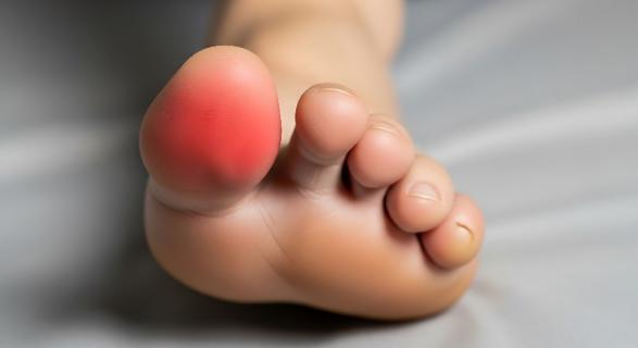 pédicure cors aux pieds